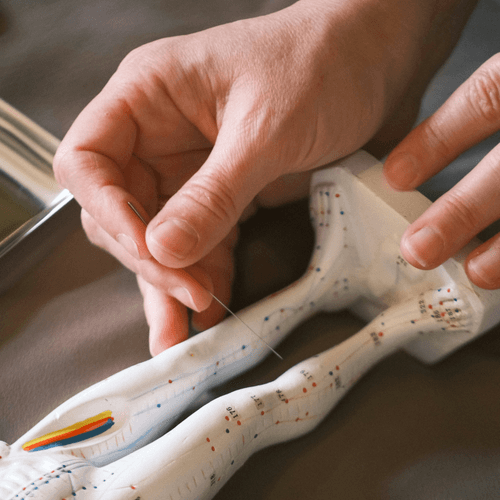 Dao Acupuncture Treatment with Dr. Paul C. Wang