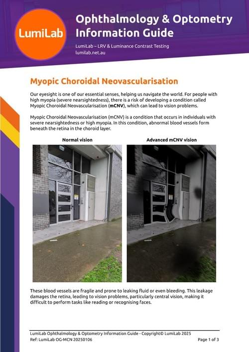 Myopic Choroidal Neovascularisation: Ophthalmology & Optometry Information Guide