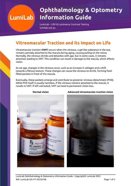 Vitreomacular Traction and its Impact on Life: Ophthalmology & Optometry Information Guide