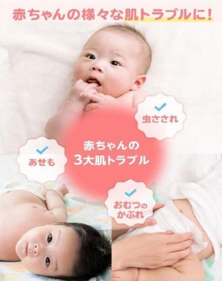 【日本直送】池田模範堂 Muhi無比滴BABY 蚊蟲叮咬止癢軟膏 出生1個月後適用 15g 大阪實體藥妝店直送