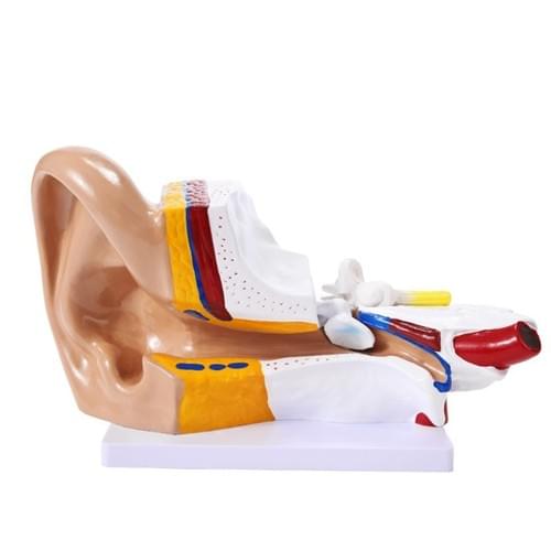 3X Ear Pathology Model Detachable Human Anatomic Medical Teaching Learning Display Aid Anatomy Tools