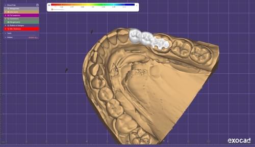 Serviciul de design digital #D CAD/CAM