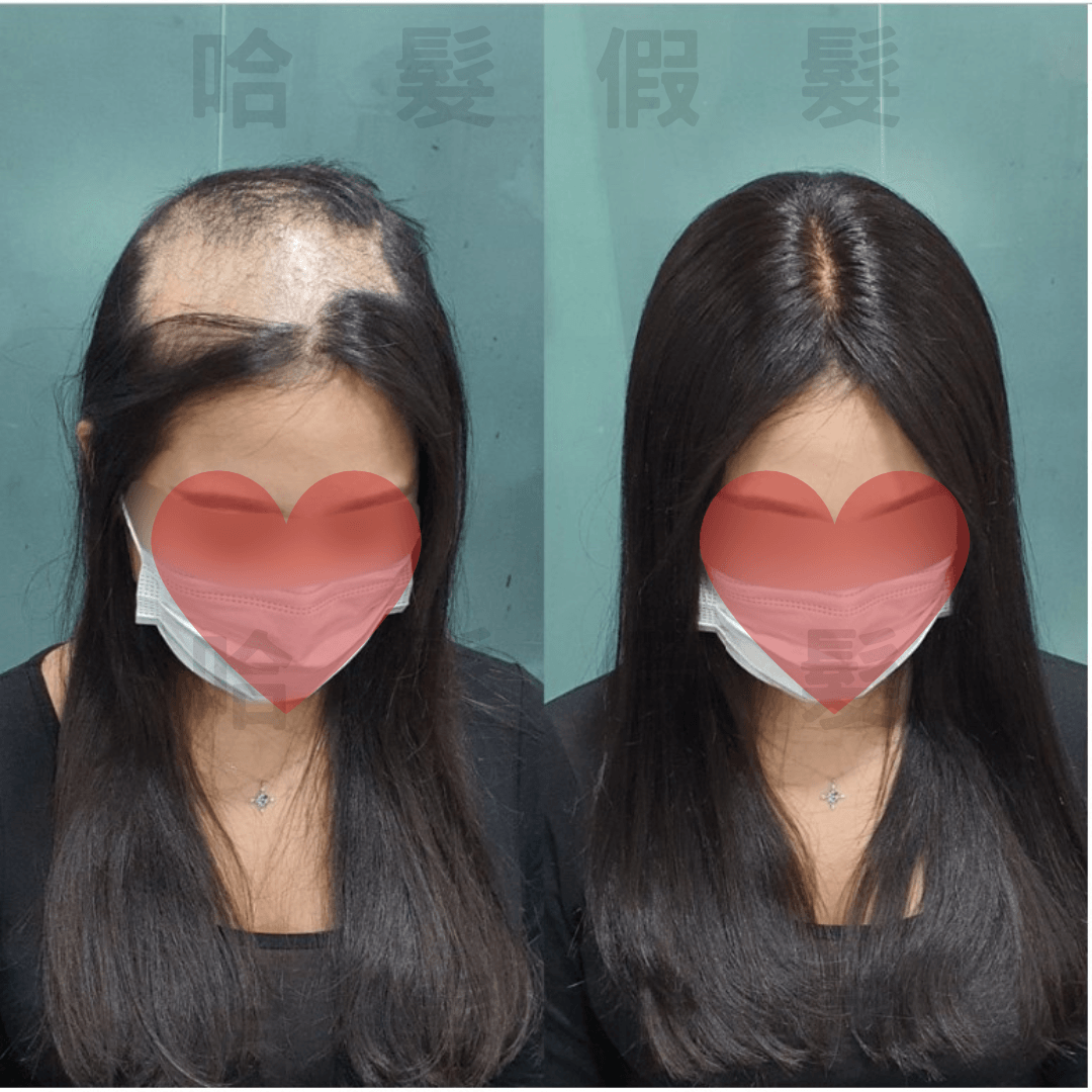 哈髮科技假髮遮白髮髮片：女士長直髮頭頂增髮前後