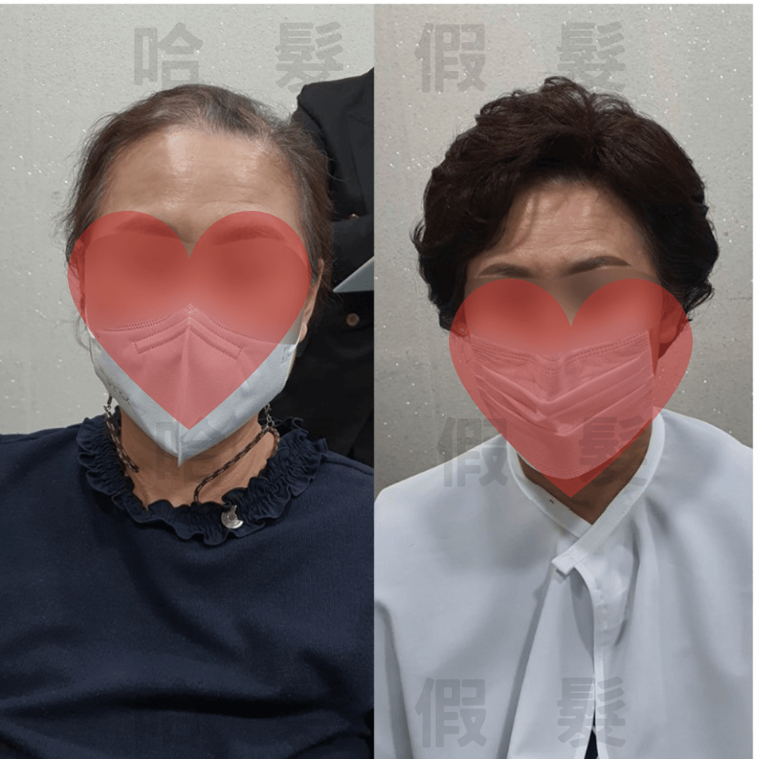 哈髮科技假髮遮白髮髮片：熟齡女士短捲髮配戴前後