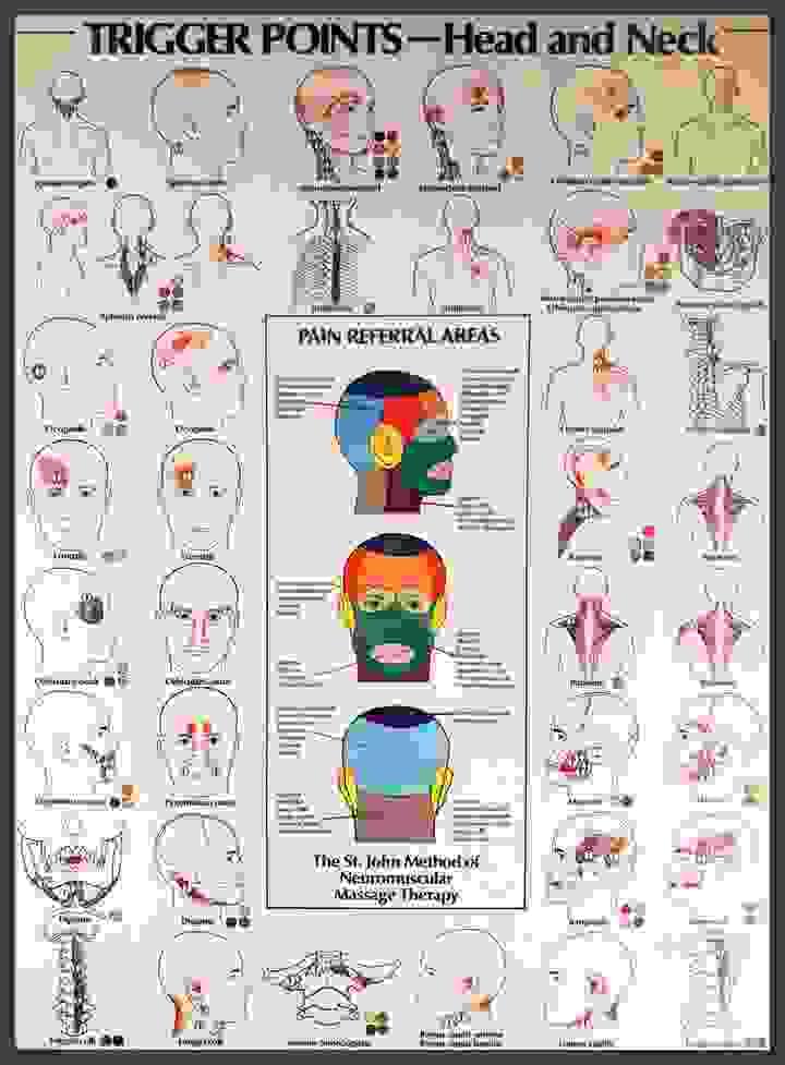 Neuromuscular therapy trigger point chart