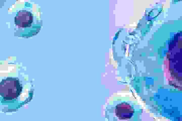 broken image