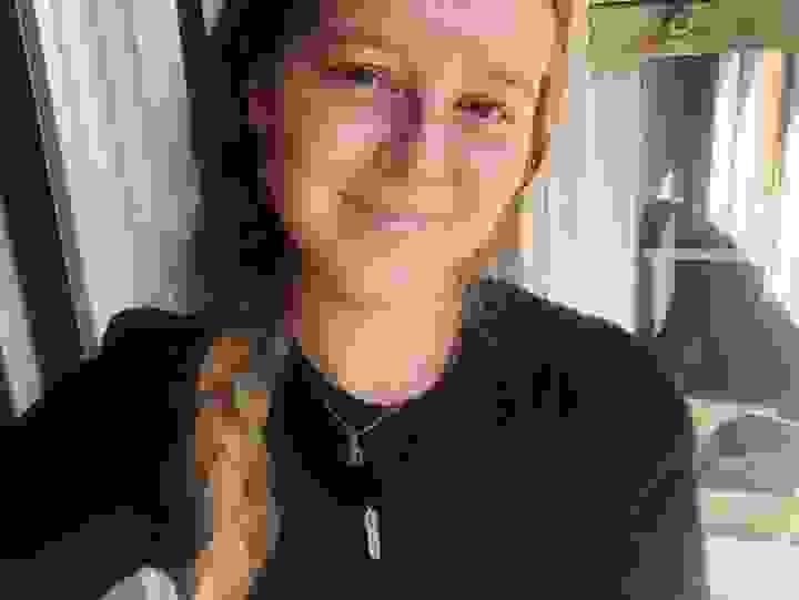 broken image