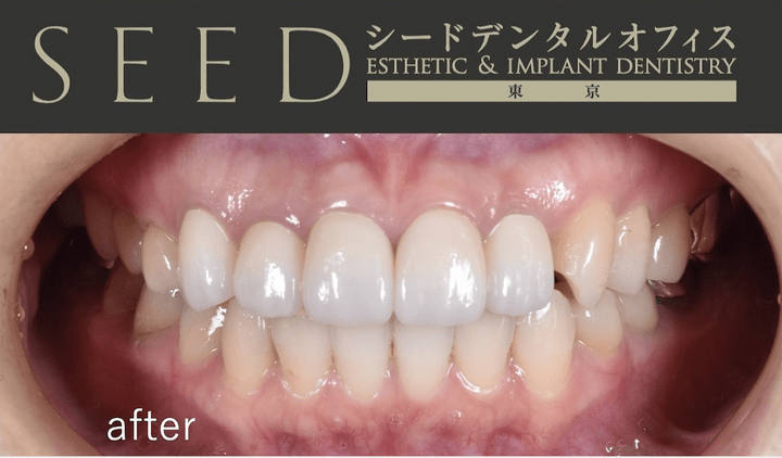 米国補綴専門医Dr.Hakuの公式ホームページ