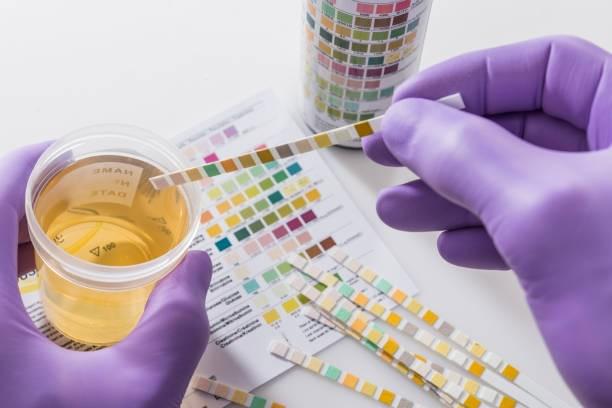 Review on Drug Doping