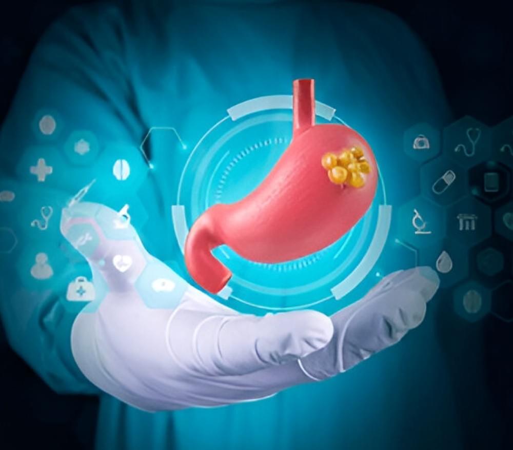 How Doctors Choose the Right Stomach Cancer Treatment Plan