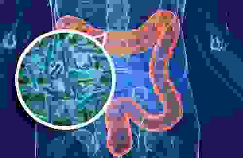 Section image