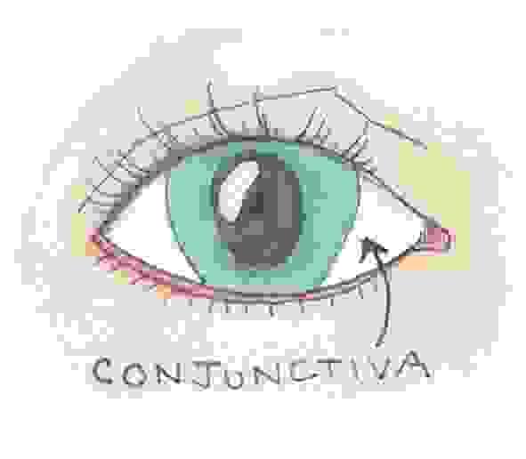 conjunctiva; eye; anatomy; @carmel.md; Eye Dogtor Julie