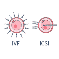 IVF/ICSI