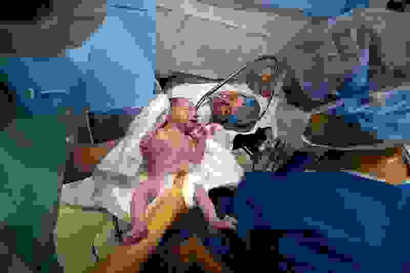 broken image