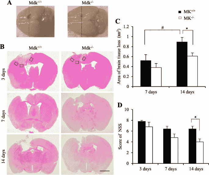 What does mdk stand for