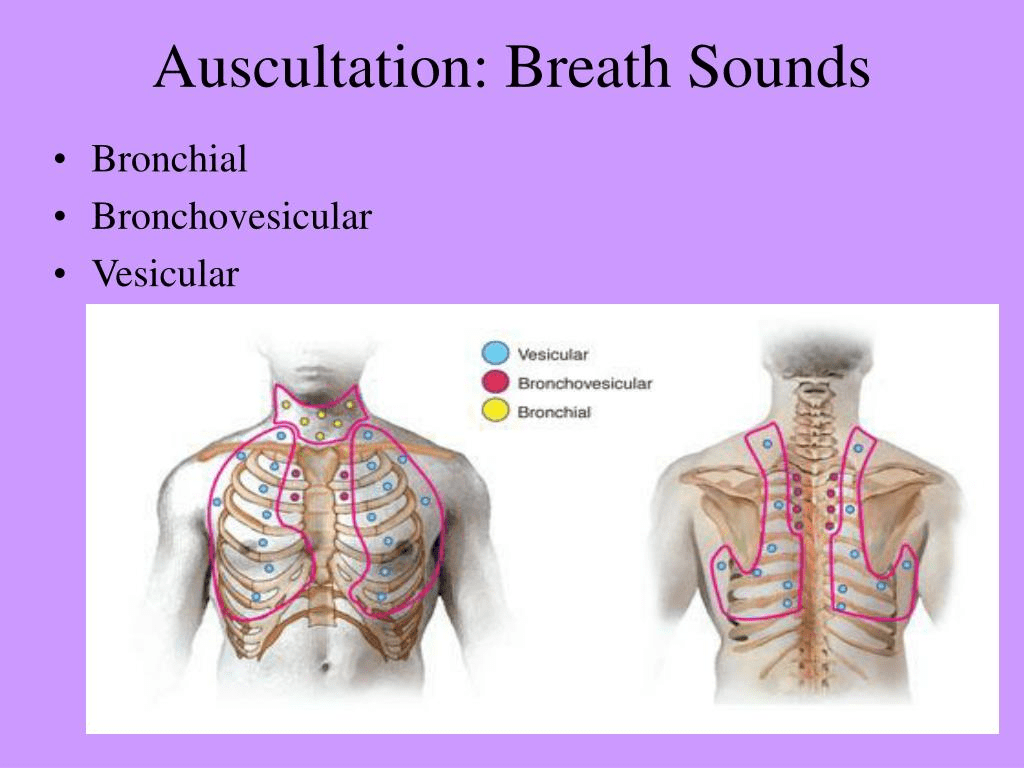Consolidation lung sounds