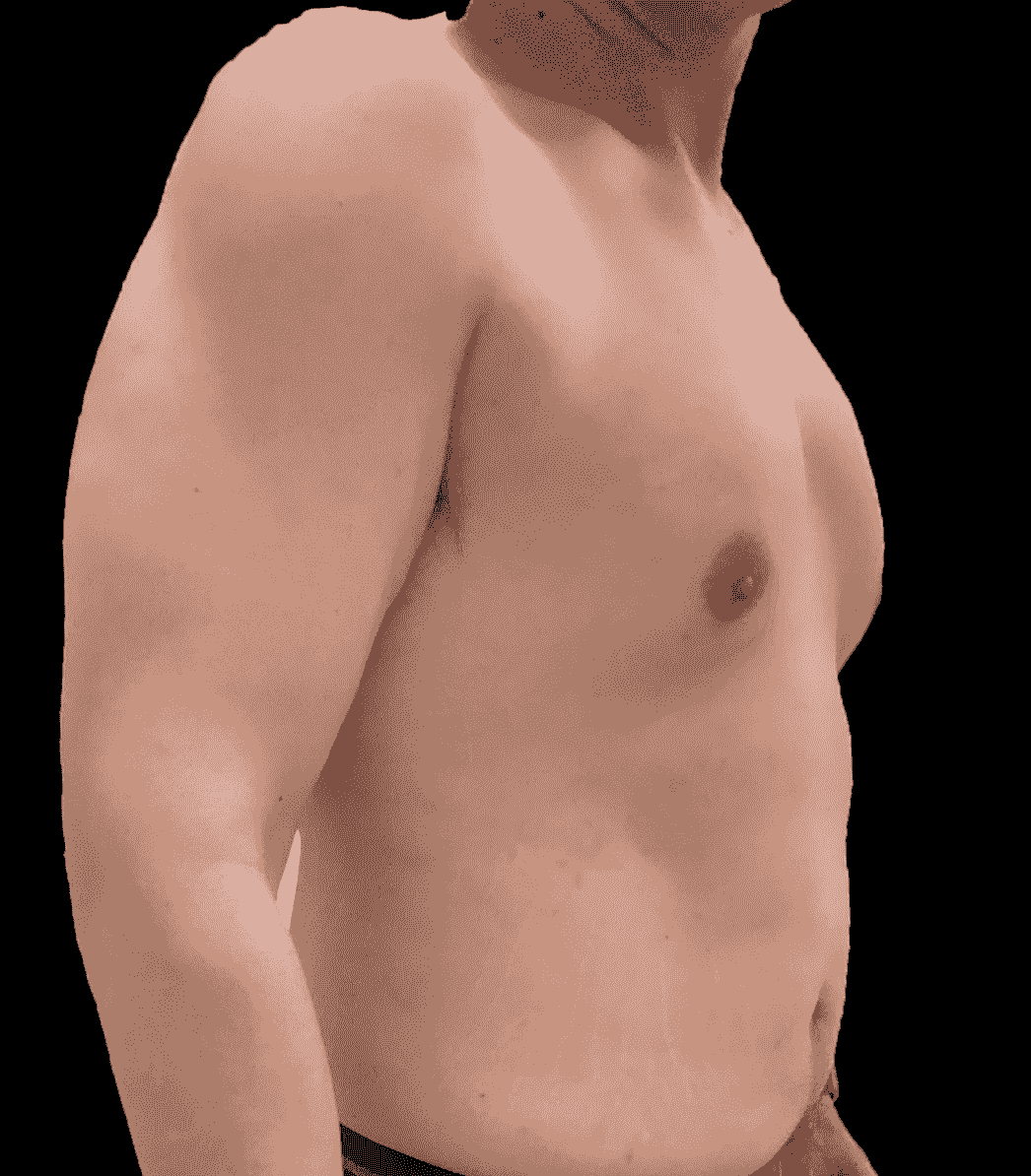 broken image