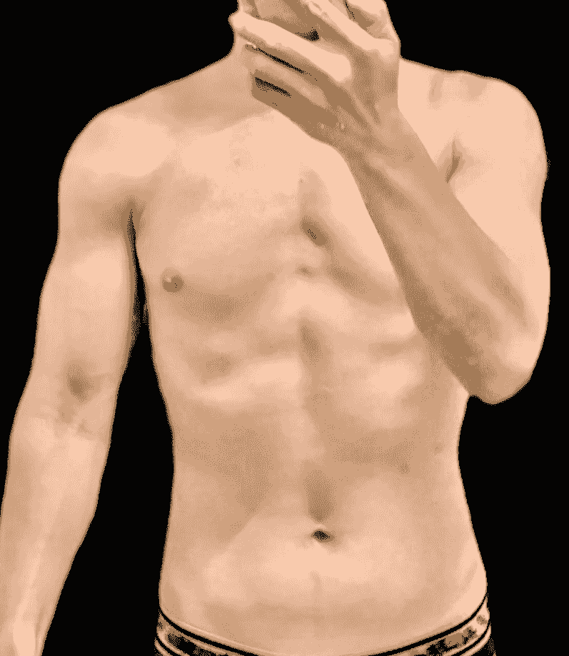 broken image