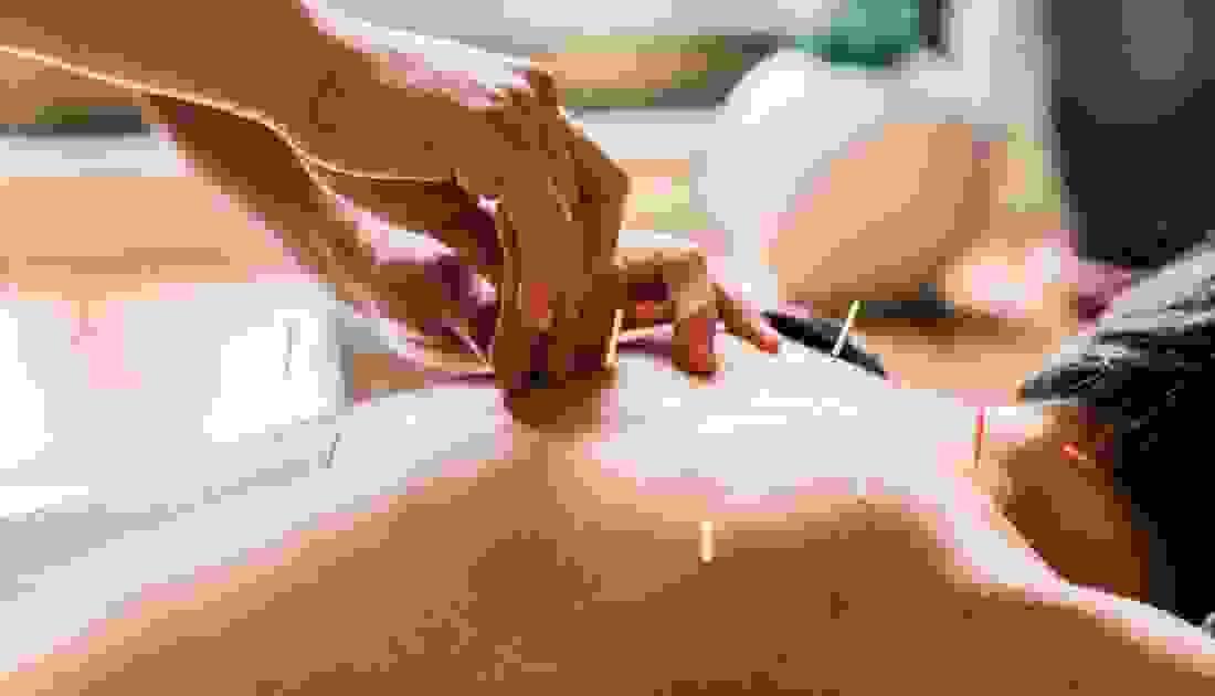 broken image