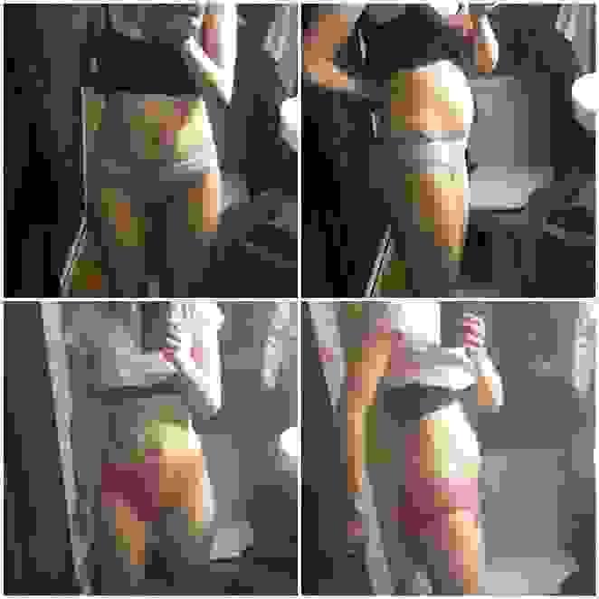 broken image