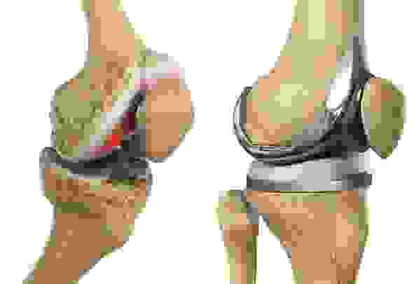 Section image