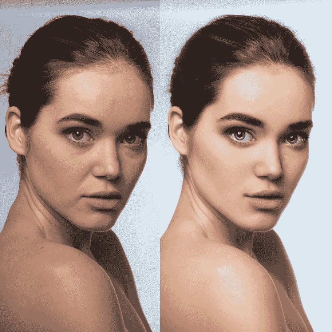 肌補正プラン|主題となる人物の肌補正のみを行うスタンダードな補正プラン 肌補正プラン|主題となる人物の肌補正のみを行うスタンダードな補正プラン