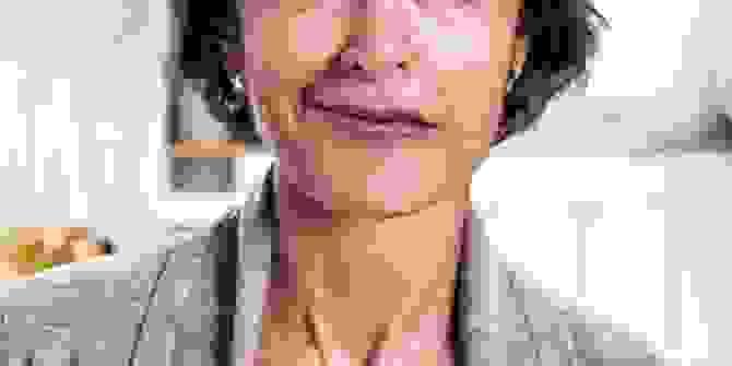 PENYAKIT STROKE