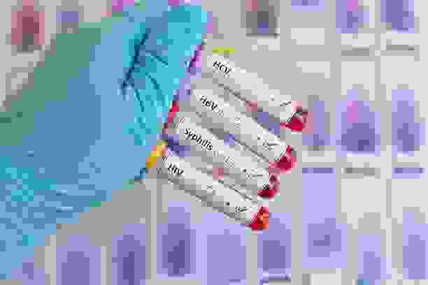 broken image