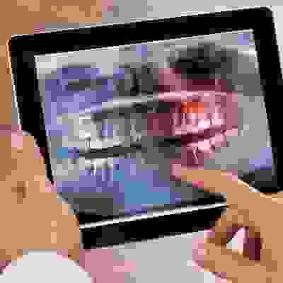 broken image