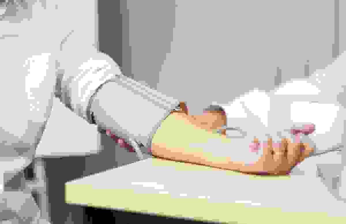 broken image