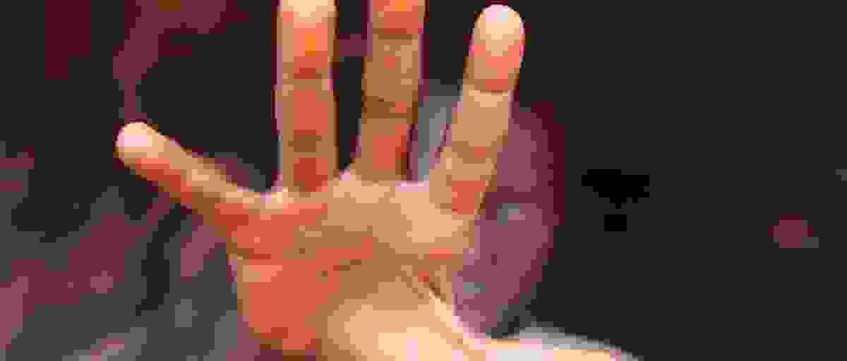 broken image