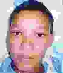 broken image