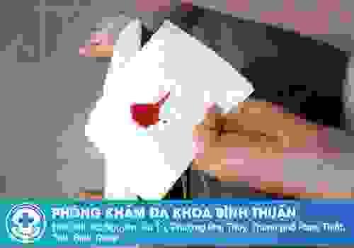 broken image