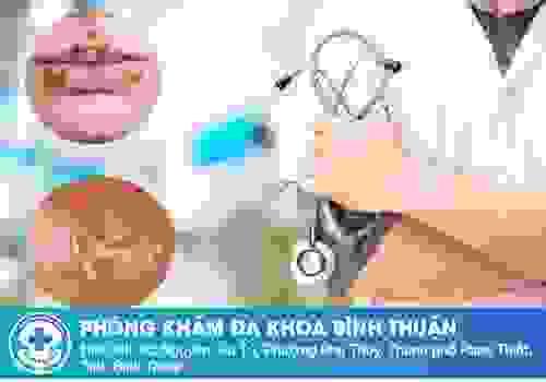 broken image