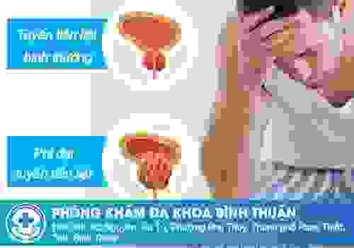 broken image