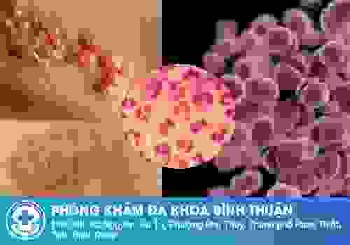 broken image