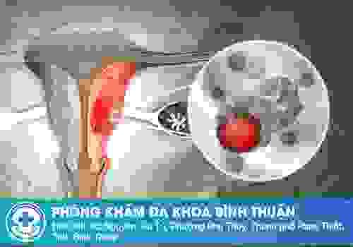 broken image