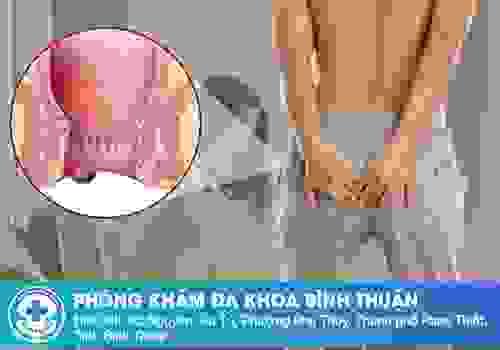 broken image