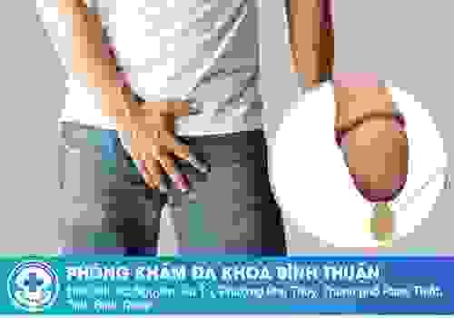 broken image