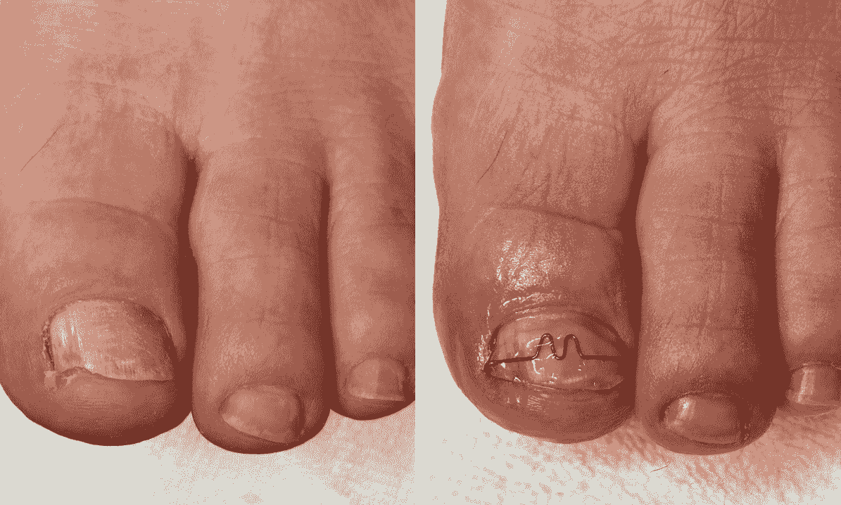 耐恩適維持器-合作店家案例Gina 耐恩適維持器-合作店家案例Gina