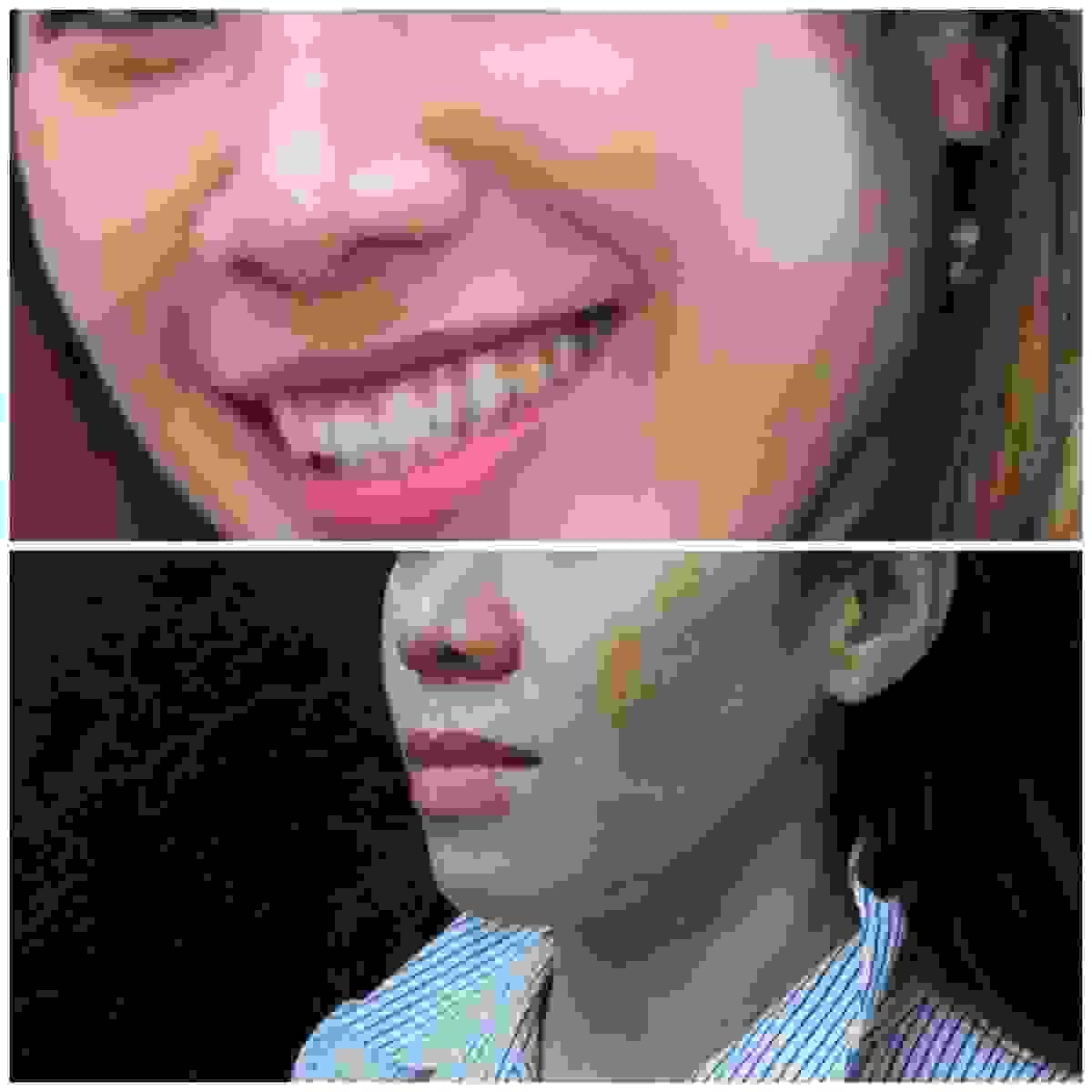 broken image
