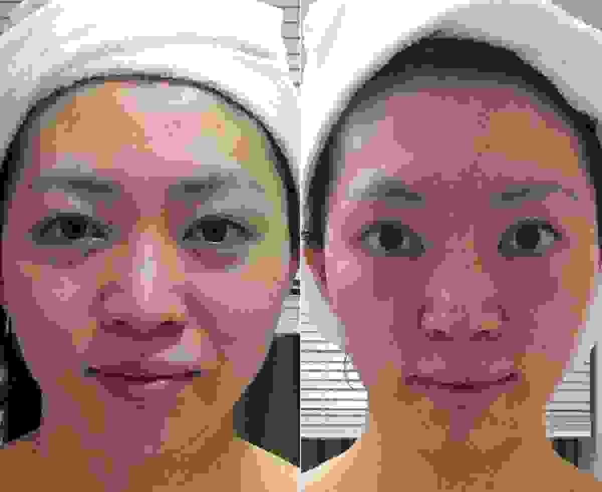 broken image