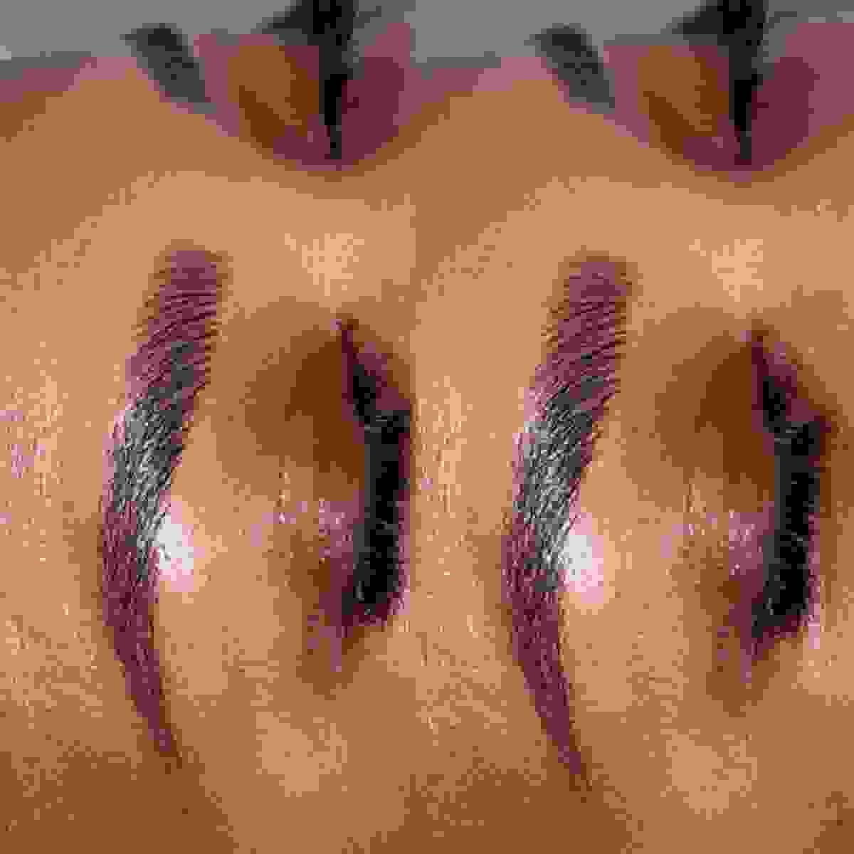 Dermopigmentation des soucils