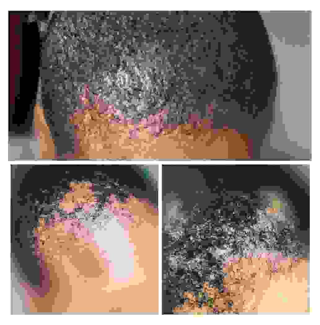 broken image