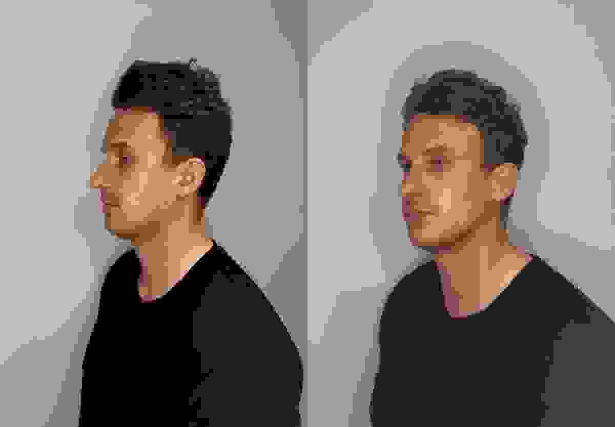 broken image