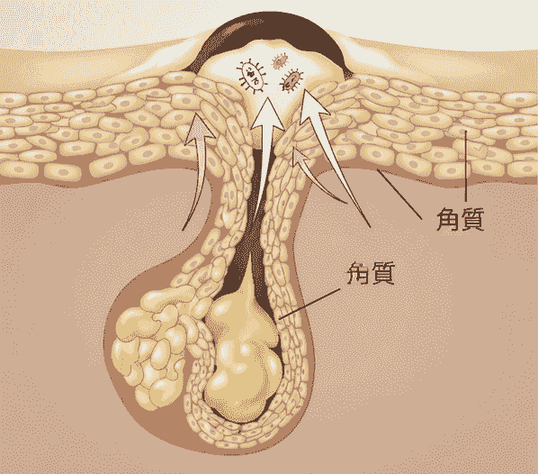 Section image