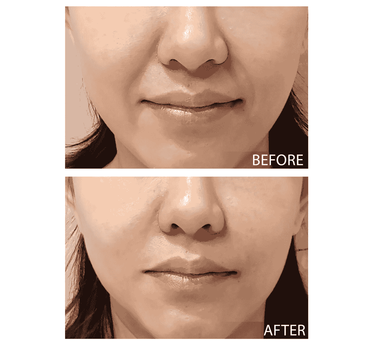 Please create a one-page official website for a Hong Kong medical beauty brand.
Brand Name: Dr.Afterhour
Brand Subname: Afternoon Care Center
Brand Type: Medical Beauty Center
Website Language: Mainly Traditional Chinese, treatment names can be kept in English.
Target Audience: Women in Hong Kong aged 25–50 who focus on anti-aging, contour enhancement, skin quality improvement, and body management.
Please establish the following sections:
1. Hero Banner
2. About Brand Introduction
3. Treatments Classification
4. Featured Treatments
5. Why Choose Us
6. Consultation CTA
7. Contact Us
Main website goal:
Build a high-end medical aesthetic brand image, clearly display treatment classifications, and guide customers to WhatsApp for inquiries and appointment assessments.