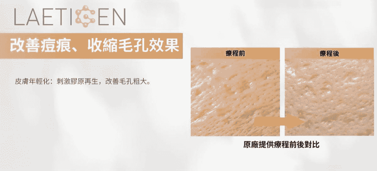 Professional medical beauty, show confidence's beauty Please create a one-page official website for a Hong Kong medical beauty brand.
Brand Name: Dr.Afterhour
Brand Subtitle: Afternoon Care Center
Brand Type: Medical Beauty Center
Website Language: Mainly Traditional Chinese, treatment names can be kept in English.
Target Audience: Women in Hong Kong aged 25–50 who focus on anti-aging, contour enhancement, skin quality improvement, and body management.
Please establish the following sections:
1. Hero Banner
2. About Brand Introduction
3. Treatments Categories
4. Featured Treatments
5. Why Choose Us
6. Consultation CTA
7. Contact Us
Main website goal:
Build a high-end medical aesthetic brand image, clearly display treatment categories, and guide customers to WhatsApp for inquiries and appointment assessments. Professional medical beauty, show confidence's beauty Please create a one-page official website for a Hong Kong medical beauty brand.
Brand Name: Dr.Afterhour
Brand Subtitle: Afternoon Care Center
Brand Type: Medical Beauty Center
Website Language: Mainly Traditional Chinese, treatment names can be kept in English.
Target Audience: Women in Hong Kong aged 25–50 who focus on anti-aging, contour enhancement, skin quality improvement, and body management.
Please establish the following sections:
1. Hero Banner
2. About Brand Introduction
3. Treatments Categories
4. Featured Treatments
5. Why Choose Us
6. Consultation CTA
7. Contact Us
Main website goal:
Build a high-end medical aesthetic brand image, clearly display treatment categories, and guide customers to WhatsApp for inquiries and appointment assessments.