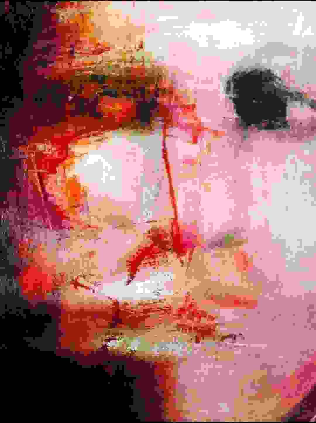 broken image
