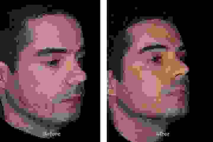 broken image